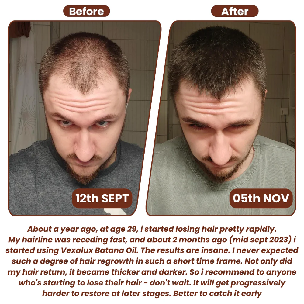 Grows Pure Batana Oil - Image 4